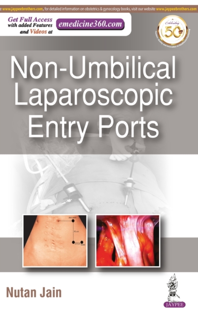 Non-Umbilical Laparoscopic Entry Ports, Hardback Book