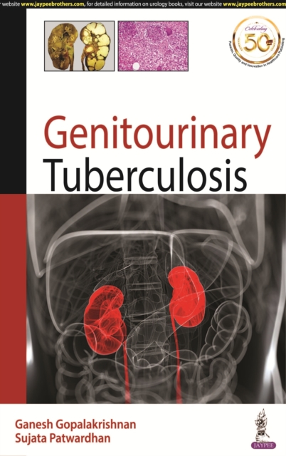 Genitourinary Tuberculosis, Paperback / softback Book
