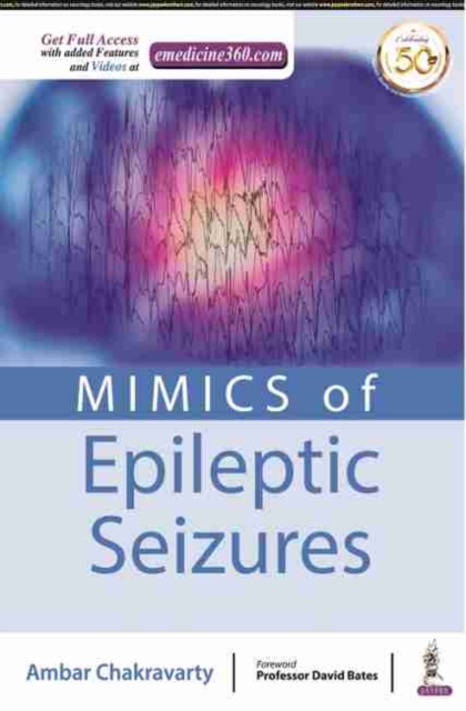 MIMICS of Epileptic Seizures, Paperback / softback Book