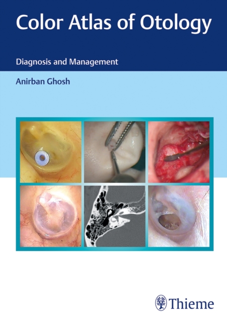 Color Atlas of Otology : Diagnosis and Management, Hardback Book