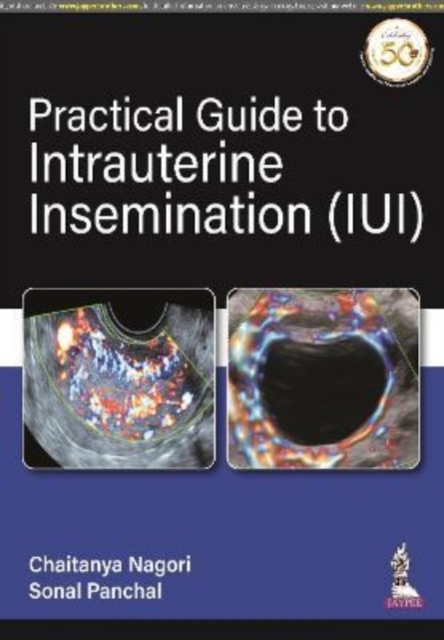 Practical Guide to Intrauterine Insemination (IUI), Paperback / softback Book