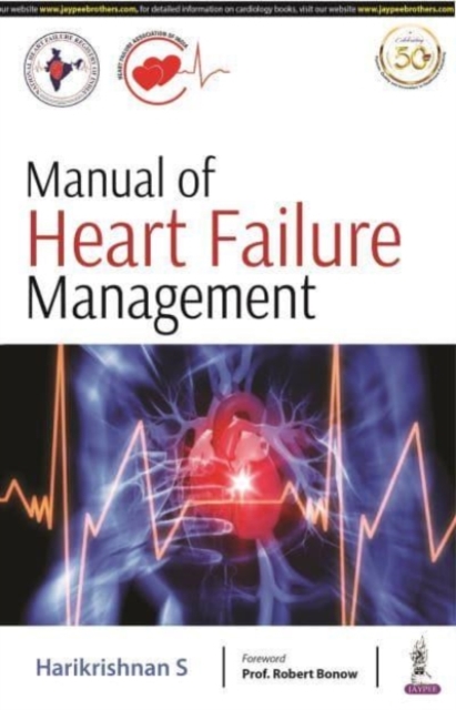 Manual of Heart Failure Management, Paperback / softback Book