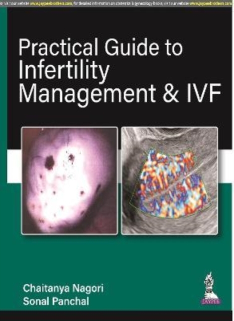 Practical Guide to Infertility Management & IVF, Paperback / softback Book
