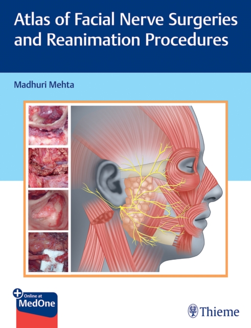 Atlas of Facial Nerve Surgeries and Reanimation Procedures, Multiple-component retail product, part(s) enclose Book