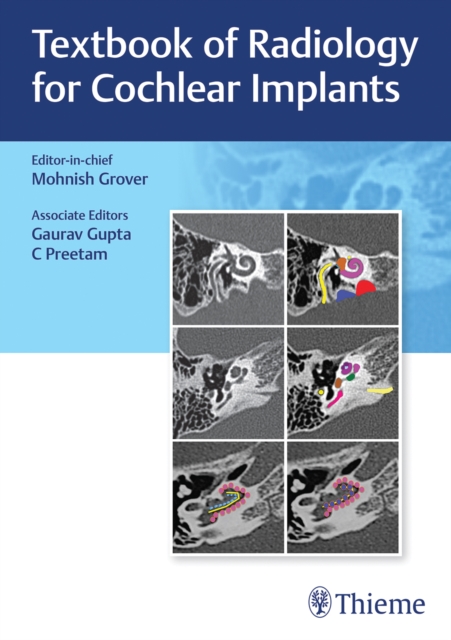 Textbook of Radiology for Cochlear Implants, Hardback Book