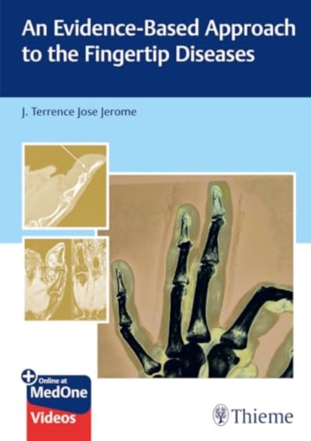 An Evidence-Based Approach to the Fingertip Diseases, Multiple-component retail product, part(s) enclose Book