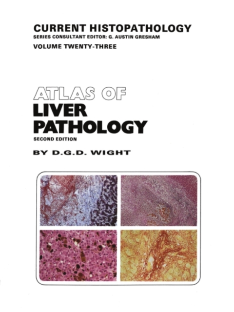 Atlas of Liver Pathology, PDF eBook