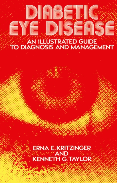 Diabetic Eye Disease : An Illustrated Guide to Diagnosis and Management, PDF eBook