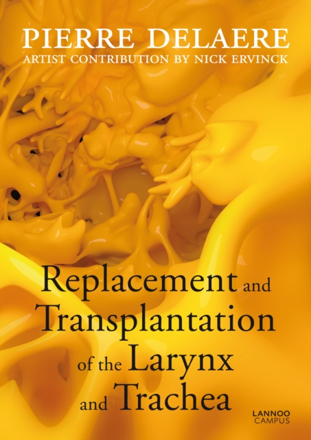 Replacement and Transplant of the Larynx and Trachea, Paperback / softback Book