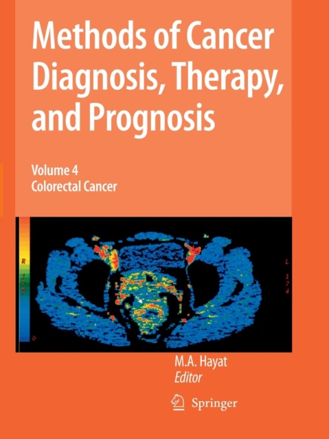 Methods of Cancer Diagnosis, Therapy and Prognosis : Colorectal Cancer, Paperback / softback Book