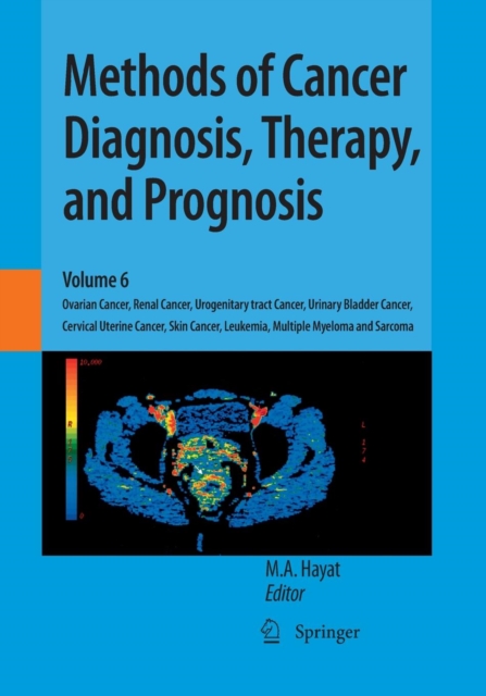 Methods of Cancer Diagnosis, Therapy, and Prognosis : Ovarian Cancer, Renal Cancer, Urogenitary tract Cancer, Urinary Bladder Cancer, Cervical Uterine Cancer, Skin Cancer, Leukemia, Multiple Myeloma a, Paperback / softback Book