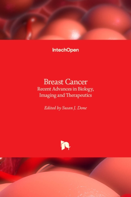 Breast Cancer : Recent Advances in Biology, Imaging and Therapeutics, Hardback Book