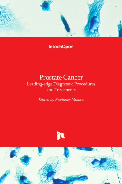 Prostate Cancer : Leading-edge Diagnostic Procedures and Treatments, Hardback Book