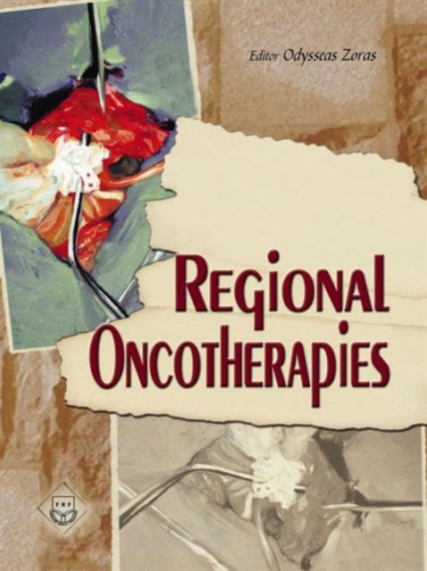 Regional Oncotherapies, Hardback Book