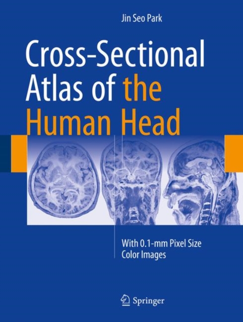 Cross-Sectional Atlas of the Human Head : With 0.1-mm pixel size color images, Hardback Book