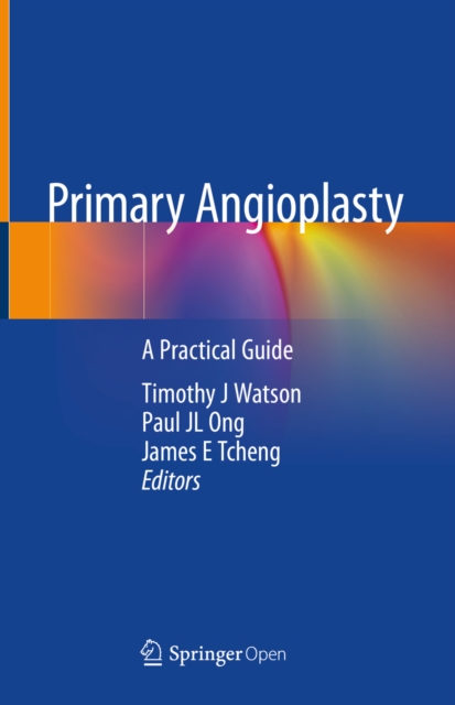 Primary Angioplasty : A Practical Guide, EPUB eBook