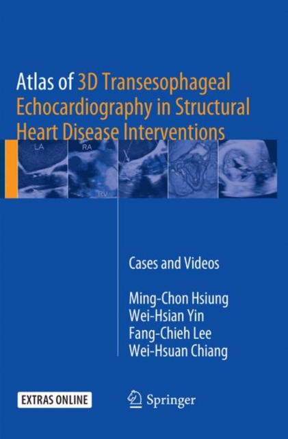 Atlas of 3D Transesophageal Echocardiography in Structural Heart Disease Interventions : Cases and Videos, Paperback / softback Book