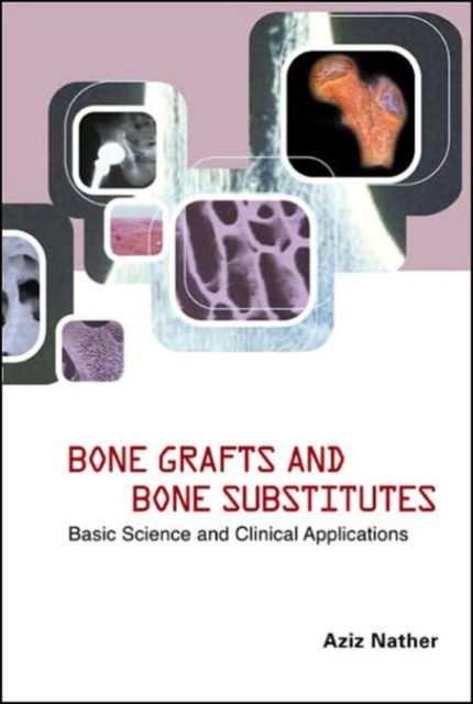 Bone Grafts And Bone Substitutes: Basic Science And Clinical Applications, Hardback Book