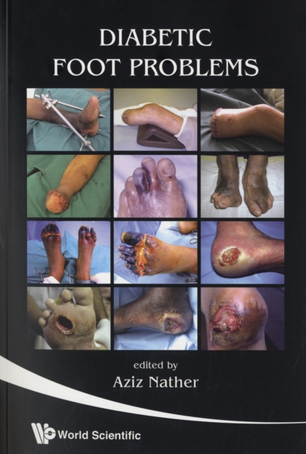 Diabetic Foot Problems, Paperback / softback Book