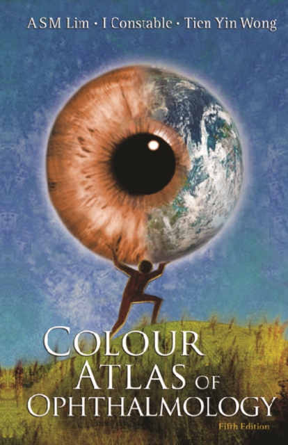 Colour Atlas Of Ophthalmology (5th Edition), PDF eBook
