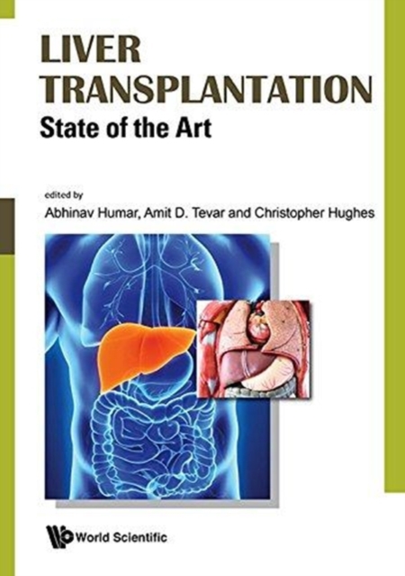Liver Transplantation: State Of The Art, Hardback Book