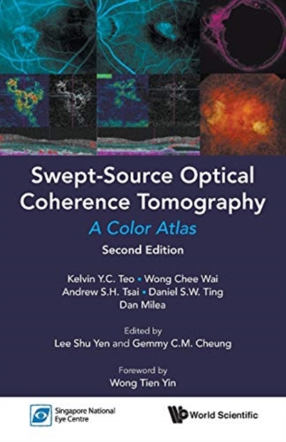 Swept-source Optical Coherence Tomography: A Color Atlas, Paperback / softback Book
