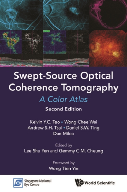 Swept-source Optical Coherence Tomography: A Color Atlas (Second Edition), EPUB eBook