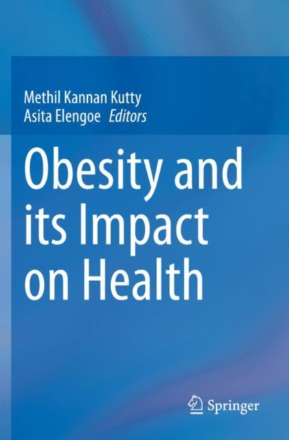 Obesity and its Impact on Health, Paperback / softback Book