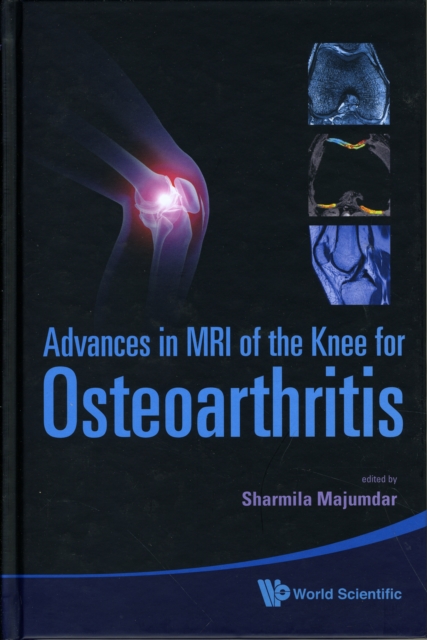 Advances In Mri Of The Knee For Osteoarthritis, Hardback Book