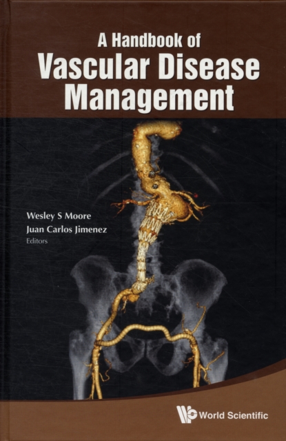 Handbook Of Vascular Disease Management, A, Hardback Book
