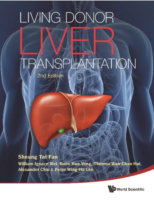 Living Donor Liver Transplantation (2nd Edition), PDF eBook