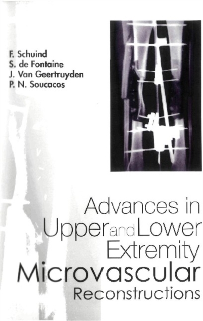 Advances In Upper And Lower Extremity Microvascular Reconstructions, PDF eBook