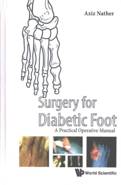 Surgery For Diabetic Foot: A Practical Operative Manual, Hardback Book