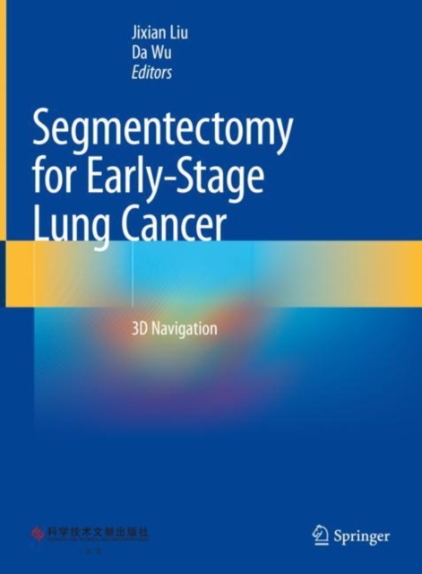 Segmentectomy for Early-Stage Lung Cancer : 3D Navigation, EPUB eBook