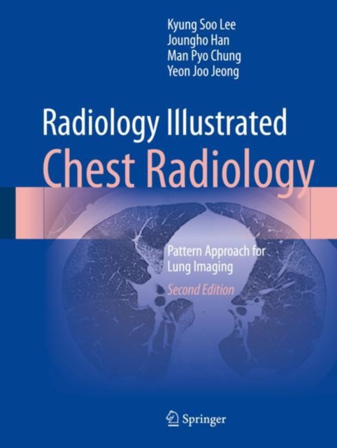 Radiology Illustrated: Chest Radiology : Pattern Approach for Lung Imaging, EPUB eBook