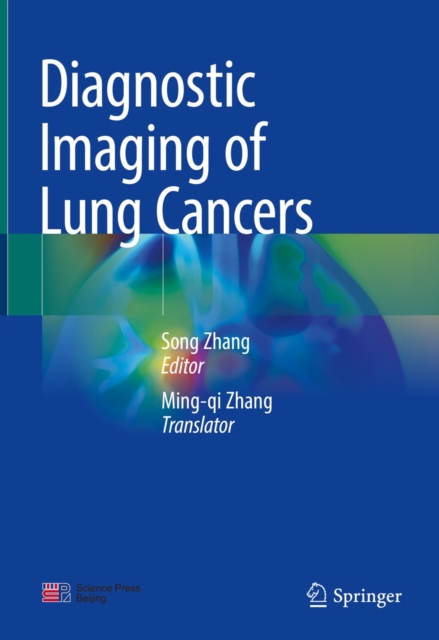 Diagnostic Imaging of Lung Cancers, EPUB eBook
