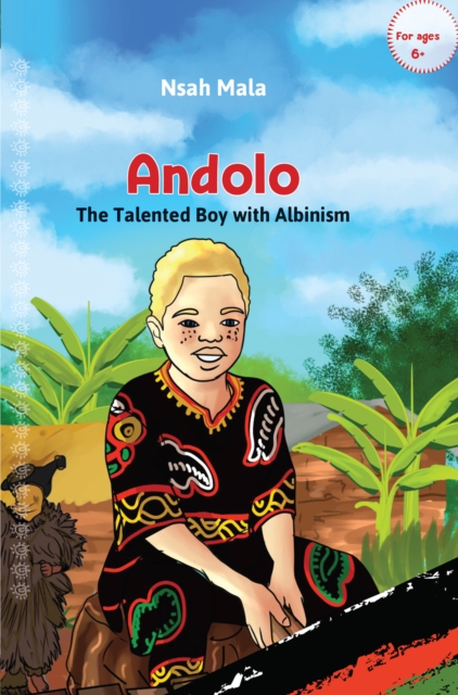 Andolo: : The Talented Boy with Albinism, EPUB eBook
