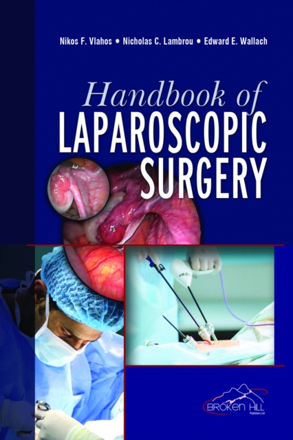 Handbook of Laparoscopic Surgery, Paperback / softback Book