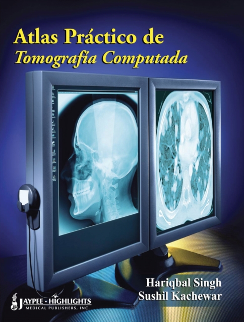 Atlas Practico De Tomografia Computada, Hardback Book