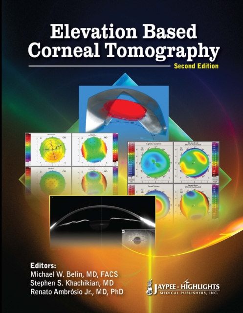 Elevation Based Corneal Tomography, Hardback Book