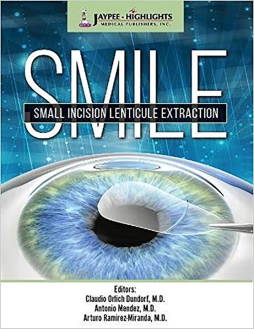 SMILE : Small Incision Lenticule Extraction, Hardback Book