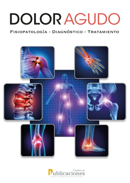 Dolor agudo. Fisiopatologia-Diagnostico-Tratamiento, EPUB eBook